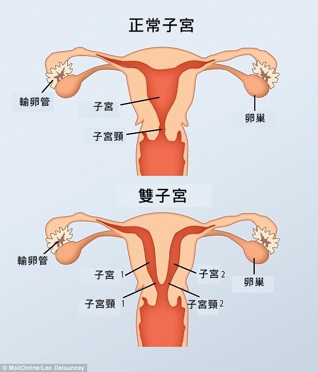 2829BEA000000578-3062172-When_the_female_foetus_is_developing_two_tubes_normally_join_to_-a-43_1430388499103f